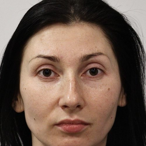 29