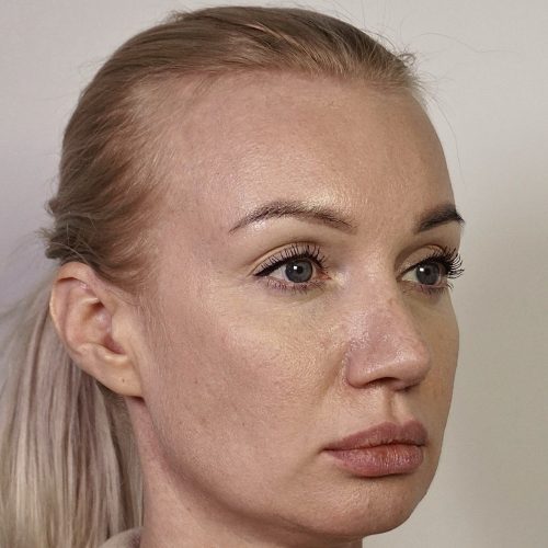38