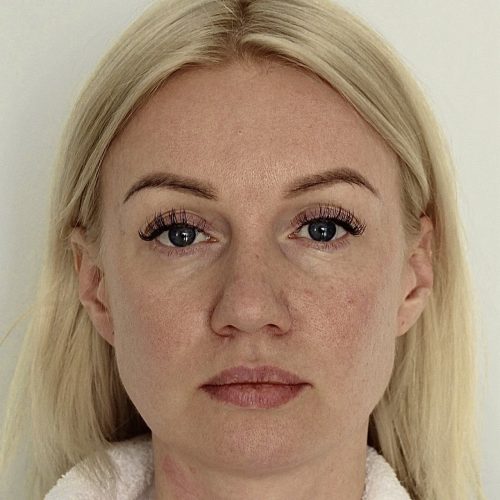41