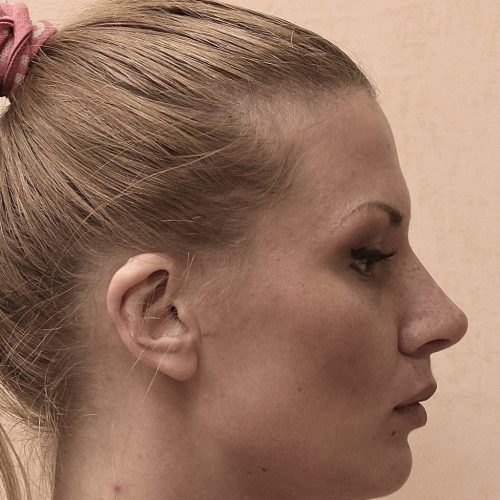 46