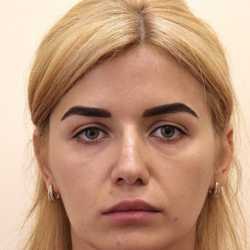 72