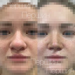 Processed with MOLDIV