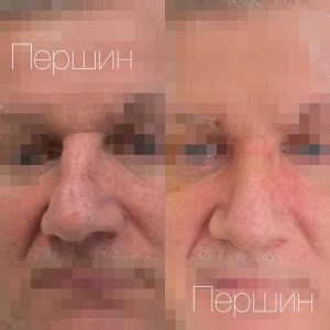 Processed with MOLDIV