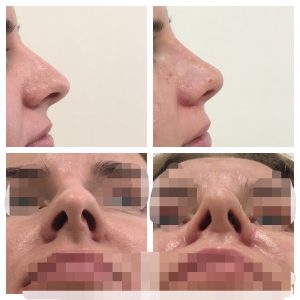 Processed with MOLDIV