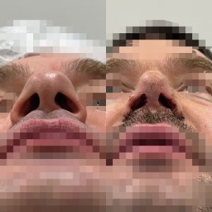 Processed with MOLDIV